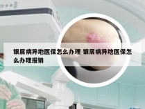 银屑病异地医保怎么办理 银屑病异地医保怎么办理报销