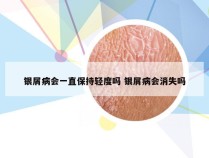 银屑病会一直保持轻度吗 银屑病会消失吗