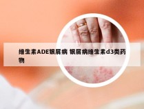 维生素ADE银屑病 银屑病维生素d3类药物