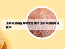 温州银屑病医院哪家比较好 温州银屑病专科医院