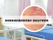 洛阳银屑病的医院哪家最好 洛阳治疗银屑病