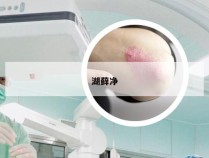 湖藓净