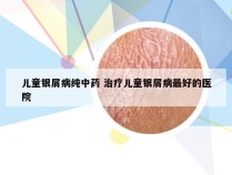 儿童银屑病纯中药 治疗儿童银屑病最好的医院
