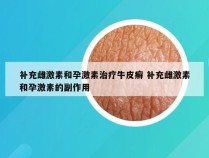 补充雌激素和孕激素治疗牛皮癣 补充雌激素和孕激素的副作用