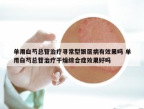 单用白芍总苷治疗寻常型银屑病有效果吗 单用白芍总苷治疗干燥综合症效果好吗