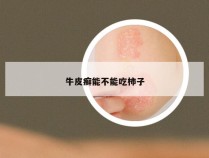 牛皮癣能不能吃柿子