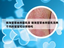 银海堂草本抑菌乳膏 银海堂草本抑菌乳膏两个月的宝宝可以使用吗