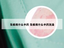 生癣用什么中药 生癣用什么中药洗澡