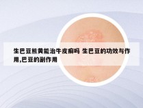 生巴豆熊黄能治牛皮癣吗 生巴豆的功效与作用,巴豆的副作用