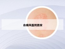 白癜风医院西安