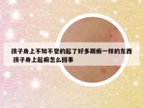 孩子身上不知不觉的起了好多跟癣一样的东西 孩子身上起癣怎么回事
