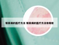 银屑病的医疗方法 银屑病的医疗方法有哪些
