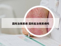 茵陈治银屑病 茵陈能治银屑病吗