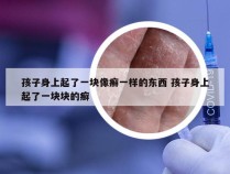 孩子身上起了一块像癣一样的东西 孩子身上起了一块块的癣