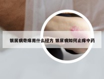 银屑病奇痒用什么经方 银屑病如何止痒中药