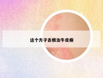 这个方子去根治牛皮癣