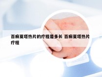 百癣夏塔热片的疗程是多长 百癣夏塔热片 疗程