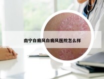 南宁白癜风白癜风医院怎么样