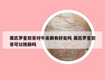 莫匹罗星软膏对牛皮癣有好处吗 莫匹罗星软膏可以擦藓吗