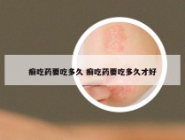 癣吃药要吃多久 癣吃药要吃多久才好