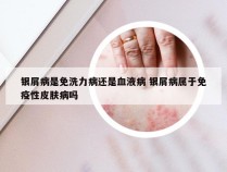 银屑病是免洗力病还是血液病 银屑病属于免疫性皮肤病吗