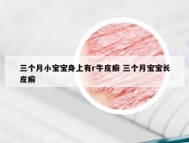 三个月小宝宝身上有r牛皮癣 三个月宝宝长皮癣