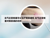白芍总苷胶囊可以治疗银屑病吗 白芍总苷胶囊对银屑病的功效