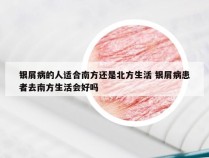 银屑病的人适合南方还是北方生活 银屑病患者去南方生活会好吗