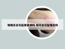 咽喉炎会引起银屑病吗 咽炎会引起喉炎吗