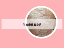 牛皮癣患者心声