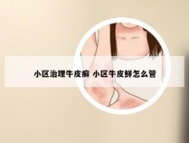 小区治理牛皮癣 小区牛皮鲜怎么管