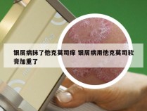 银屑病抹了他克莫司痒 银屑病用他克莫司软膏加重了