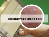 口服沙棘油对牛皮癣 沙棘治牛皮癣吗