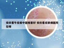 安庆看牛皮癣中医哪里好 安庆看皮肤病医院在哪