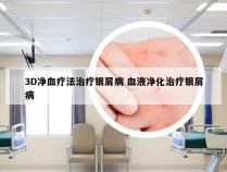 3D净血疗法治疗银屑病 血液净化治疗银屑病