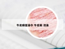 牛皮癣搓澡巾 牛皮癣 泡澡