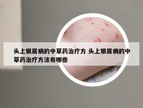 头上银屑病的中草药治疗方 头上银屑病的中草药治疗方法有哪些