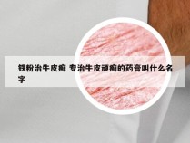 铁粉治牛皮癣 专治牛皮顽癣的药膏叫什么名字