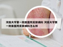 河南大学第一附属医院皮肤病科 河南大学第一附属医院皮肤病科怎么样