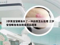 3岁男宝宝眼角长了一块白斑怎么处理 三岁宝宝眼角有白斑是怎么回事