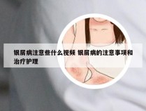 银屑病注意些什么视频 银屑病的注意事项和治疗护理
