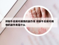 抑制牛皮癣对病情的副作用 抑制牛皮癣对病情的副作用是什么