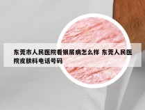 东莞市人民医院看银屑病怎么样 东莞人民医院皮肤科电话号码