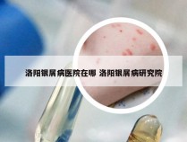 洛阳银屑病医院在哪 洛阳银屑病研究院