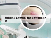 废机油可以治牛皮癣吗 废机油擦牛有什么危害