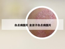 白点病图片 金波子白点病图片