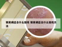 银屑病适合什么锻炼 银屑病适合什么锻炼方法