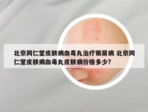 北京同仁堂皮肤病血毒丸治疗银屑病 北京同仁堂皮肤病血毒丸皮肤病价格多少?