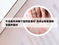 牛皮癣苏州哪个医院能看好 苏州治银屑病哪家医院最好