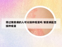 得过银屑病的人可以接种疫苗吗 银屑病能否接种疫苗